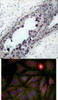 <b>Top Image:</b> Immunohistochemical analysis of paraffin-embedded human breast carcinoma tissue, using PTEN (Phospho-Ser380/Thr382/Thr383) .<b>Bottom Image:</b> Immunofluorescence staining of methanol-fixed HeLa cells using PTEN (Phospho-Ser380/Thr382/Thr383) .