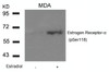 Western blot analysis of lysed extracts from MDA cells untreated or treated with Estradiol using Estrogen Receptor-&#945; (Phospho-Ser118) .
