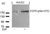 Western blot analysis of lysed extracts from HUVEC cells untreated or treated with EGF using EGFR (Phospho-Ser1070) .