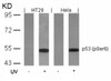 Western blot analysis of lysed extracts from HT29 and HeLa cells untreated or treated with UV using p53 (Phospho-Ser6) .