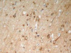 Immunohistochemical analysis of paraffin-embedded rat hippocampal region tissue from a model with Alzheimer’s Disease using Tau (Phospho-Ser396) .