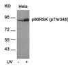 Western blot analysis of lysed extracts from HeLa cells untreated or treated with UV using p90RSK (Phospho-Thr348) .