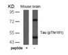 Western blot analysis of lysed extracts from mouse brain tissue using Tau (Phospho-Thr181) .