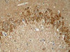 Immunohistochemical analysis of paraffin-embedded rat hippocampal region tissue from a model with Alzheimer’s Disease using Tau (Phospho-Thr181) .