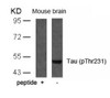 Western blot analysis of lysed extracts from mouse brain tissue using Tau (Phospho-Thr231) .