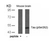 Western blot analysis of lysed extracts from mouse brain tissue using Tau (Phospho-Ser262) .