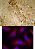 <b>Top Image:</b> Immunohistochemical analysis of paraffin-embedded rat hippocampal region tissue from a model with Alzheimer’s Disease using Tau (Phospho-Ser262) .<b>Bottom Image:</b> Immunofluorescence staining of methanol-fixed HeLa cells using Tau (Phospho-Ser262) .