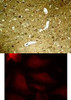 <b>Top Image:</b> Immunohistochemical analysis of paraffin-embedded rat hippocampal region tissue from a model with Alzheimer’s Disease using Tau (Phospho-Ser404) .<b>Bottom Image:</b> Immunofluorescence staining of methanol-fixed HeLa cells using Tau (Phospho-Ser404) .