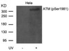 Western blot analysis of lysed extracts from HeLa cells untreated or treated with UV using ATM (Phospho-Ser1981) .