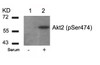Western blot analysis of lysed extracts from 293 cells untreated (Lane 1) or treated with serum (lane 2) using Akt2 (Phospho-Ser474) .