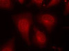 Immunofluorescence staining of methanol-fixed HeLa cells using HDAC8 (Phospho-Ser39) .