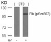 Western blot analysis of lysed extracts from 3T3 cells untreated or treated with UV using Rb (Phospho-Ser807) .
