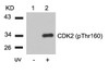 Western blot analysis of lysed extracts from HeLa cells untreated (Lane 1) or treated with UV (lane 2) using CDK2 (Phospho-Thr160) Antibody.