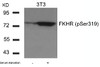 Western blot analysis of lysed extracts from 3T3 cells untreated or treated with serum starvation using FKHR (Phospho-Ser319) .