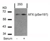 Western blot analysis of lysed extracts from 293 cells untreated or treated with serum using AFX (Phospho-Ser197) .