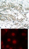 <b>Top Image:</b> Immunohistochemical analysis of paraffin-embedded human breast carcinoma tissue using AFX (Phospho-Ser197) .<b>Bottom Image:</b> Immunofluorescence staining of methanol-fixed MCF7 cells using AFX (Phospho-Ser197) .