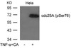 Western blot analysis of lysed extracts from HeLa cells untreated or treated with TNF-&#945; and CA using cdc25A (Phospho-Ser76) .