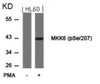 Western blot analysis of lysed extracts from HL60 cells untreated or treated with PMA using MKK6 (Phospho-Ser207) .