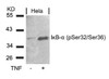 Western blot analysis of lysed extracts from HeLa cells untreated or treated with TNF using I&#954;B-&#945; (Phospho-Ser32/Ser36) .