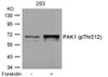 Western blot analysis of lysed extracts from 293 cells untreated or treated with forskolin using PAK1 (Phospho-Thr212) .