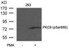 Western blot analysis of lysed extracts from 293 cells untreated or treated with PMA using PKC&#920; (Phospho-Ser695) .