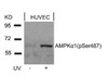 Western blot analysis of lysed extracts from HUVEC cells untreated or treated with UV using AMPK&#945;1 (Phospho-Ser487) Antibody.