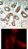 <b>Top Image:</b> Immunohistochemical analysis of paraffin-embedded human breast carcinoma tissue using 14-3-3 zeta (Phospho-Ser58) .<b>Bottom Image:</b> Immunofluorescence staining of methanol-fixed HeLa cells using 14-3-3 zeta (Phospho-Ser58) .