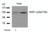 Western blot analysis of lysed extracts from HeLa cells using ADD1 (Phospho-Ser726) .
