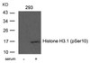 Western blot analysis of lysed extracts from 293 cells untreated or treated with serum using Histone H3.1 (Phospho-Ser10) .