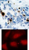 <b>Top Image:</b> Immunohistochemical analysis of paraffin-embedded human breast carcinoma tissue using Histone H3.1 (Phospho-Ser10) .<b>Bottom Image:</b> Immunofluorescence staining of methanol-fixed HeLa cells using Histone H3.1 (Phospho-Ser10) .