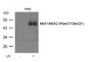 Western blot analysis of lysed extracts from HeLa cell untreated or treated with UV MEK1/MEK2 (Phospho-Ser217/Ser221) Antibody#11205