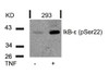 Western blot analysis of lysed extracts from 293 cells untreated or treated with TNF using IkB-&#949; (Phospho-Ser22) .