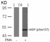 Western blot analysis of lysed extracts from C6 cells untreated or treated with PMA using VASP (Phospho-Ser157) .