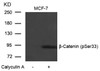 Western blot analysis of lysed extracts from MCF-7 cells untreated or treated with Calyculin A using &#946;-Catenin (Phospho-Ser33) .