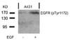 Western blot analysis of lysed extracts from A431 cells untreated or treated with EGF using EGFR (Phospho-Tyr1172) .