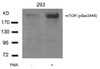 Western blot analysis of lysed extracts from 293 cells untreated or treated with PMA using mTOR (Phospho-Ser2448) .