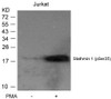 Western blot analysis of lysed extracts from Jurkat cells untreated or treated with PMA using Stathmin 1 (Phospho-Ser25) .