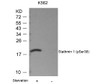 Western blot analysis of lysed extracts from K562 cells untreated or treated with starvation using Stathmin 1 (Phospho-Ser38) .