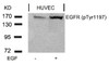 Western blot analysis of lysed extracts from HUVEC cells untreated or treated with EGF using EGFR (Phospho-Tyr1197) .