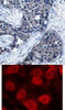 <b>Top Image:</b> Immunohistochemical analysis of paraffin-embedded human breast carcinoma tissue using eIF4E (Phospho-Ser209) .<b>Bottom Image:</b> Immunofluorescence staining of methanol-fixed MCF cells using eIF4E (Phospho-Ser209) .