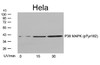 Western blot analysis of lysed extracts from HeLa cells untreated or treated with UV for the indicated times, using P38 MAPK (Phospho-Tyr182) .