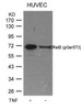 Western blot analysis of lysed extracts from HUVEC cells untreated or treated with TNF using RelB (Phospho-Ser573) .