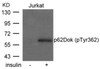 Western blot analysis of lysed extracts from Jurkat cells untreated or treated with insulin using p62Dok (phospho-Tyr362) .