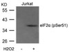 Western blot analysis of lysed extracts from Jurkat cells untreated or treated with H2O2 using eIF2&#945; (Phospho-Ser51) .