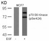 Western blot analysis of lysed extracts from MCF cells untreated or treated with EGF using p70 S6 Kinase (Phospho-Ser424) .