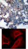 <b>Top Image:</b> Immunohistochemical analysis of paraffin-embedded human breast carcinoma tissue using p70 S6 Kinase (Phospho-Ser424) .<b>Bottom Image:</b> Immunofluorescence staining of methanol-fixed HeLa cells showing cytoplasmic, centrosomal and nuclear staining using p70 S6 Kinase (Phospho-Ser424) .