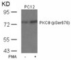 Western blot analysis of lysed extracts from PC12 cells untreated or treated with PMA using PKC&#920; (Phospho-Ser676) .