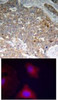 <b>Top Image:</b> Immunohistochemical analysis of paraffin-embedded human breast carcinoma tissue using GSK3&#946; (Phospho-Tyr216) .<b>Bottom Image:</b> Immunofluorescence staining of methanol-fixed HeLa cells using GSK3&#946; (Phospho-Tyr216) .