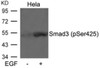Smad3 (phospho Ser425) Antibody | 79-237