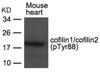 Western blot analysis of lysed extracts from Mouse heart tissue using cofilin1/cofilin2 (phospho-Tyr88) .